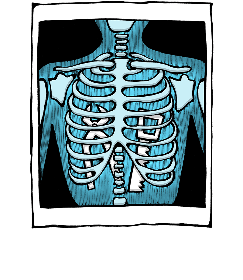 Stock illustraties röntgenfoto